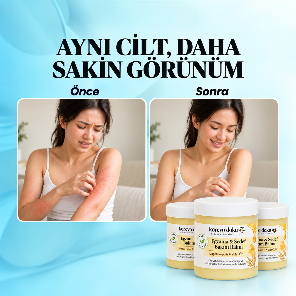 Korevo Doku Egzama - Sedef Bakım Balmı